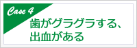 歯がグラグラする、出血がある