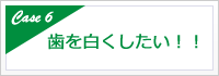 歯を白くしたい！！