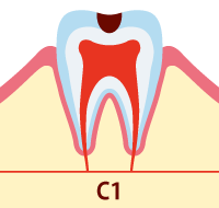 C1