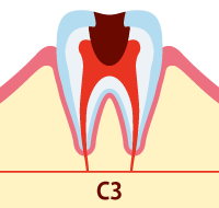 C3