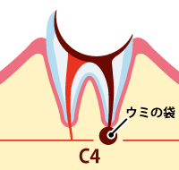 C3